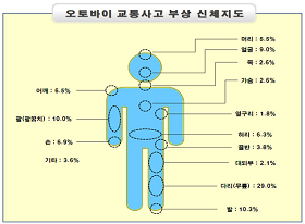 부상 신체지도
