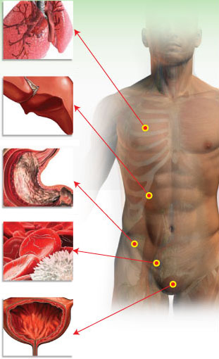 실제 디톡스 요법은 알레르기나 불안증, 관절염, 천식, 우울증, 당뇨, 두통, 심장병, 고지혈증, 소화불량이나 비만과 같은 많은 만성질환에 효과가 있다고 알려지고 있다.   