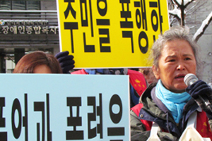 ▲손가락 골절을 당한 A씨 &copy; 김아름내     